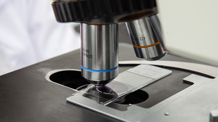 Scientist looking at liquid based cytology pap smear samples through a microscope shutterstock_2209149077.jpg