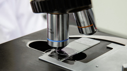 Scientist looking at liquid based cytology pap smear samples through a microscope shutterstock_2209149077.jpg