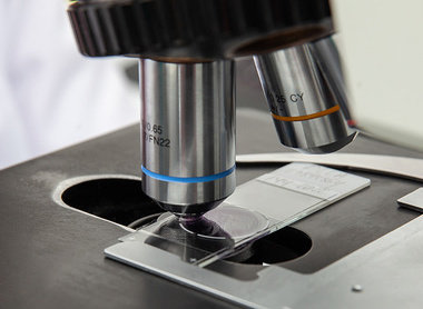 Scientist looking at liquid based cytology pap smear samples through a microscope shutterstock_2209149077.jpg