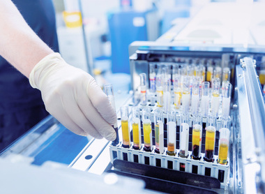 Biochemical automatic testing blood laboratories.jpg