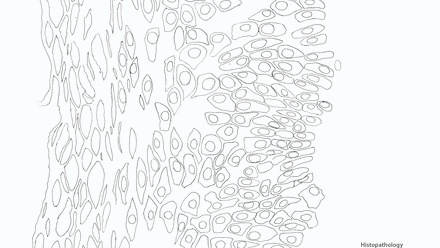 Incredible You_Histopathology Skin Tissue_Biopsy_Page_2.jpg