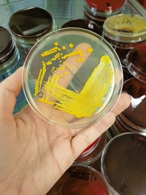 Agar plate showing colonial growth of a Staphylococcus aureus (a bacteria that can cause a wide range of severe infections.)