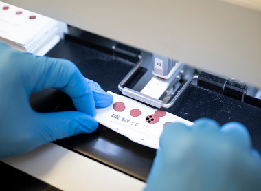 Newborn screening lab photo