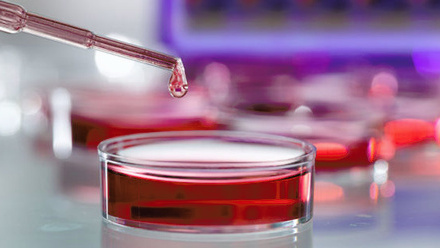 petri_dish_pipetting_haematology_19970057_785x400px.jpg