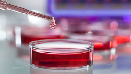 petri_dish_pipetting_haematology_19970057_785x400px.jpg