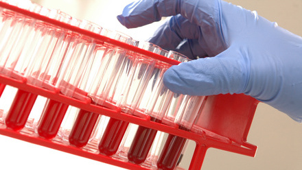 blood test tubes (haematology).jpg