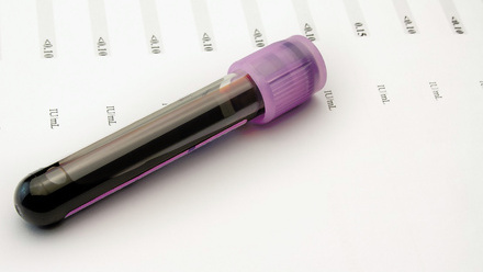 Test tube with blood on top of test results.jpg