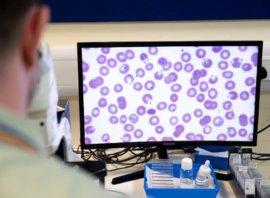 Blood sciences microscope and screen image.jpg