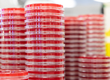 agar plates and petri dishes.jpg