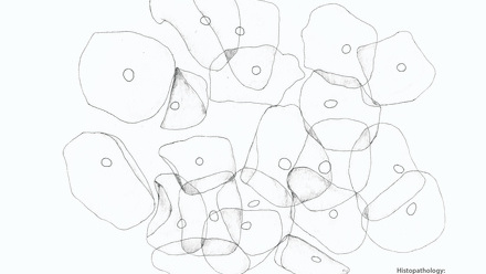 Incredible You_Histopathology - Cytopathology Cervix cells_Page_2.jpg