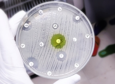 Antimicrobial susceptibility testing picture