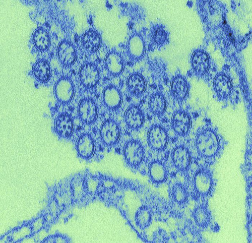 Electron microscope image of influenza viruses