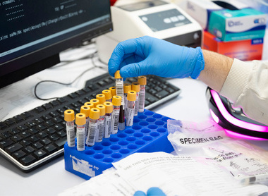 Samples in virology lab_low res.jpg