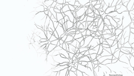 Incredible You_Neuropathology Brain Cells_Page_2.jpg