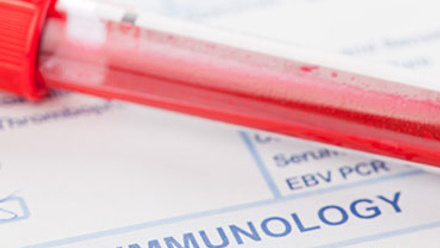 test_tube_blood_sample_immunology_370x290px.jpg
