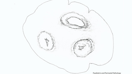 Incredible You_Paediatric and Perinatal Pathology_Page_2.jpg