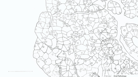 Incredible You_Oral Pathology Salivary Gland_Page_2.jpg