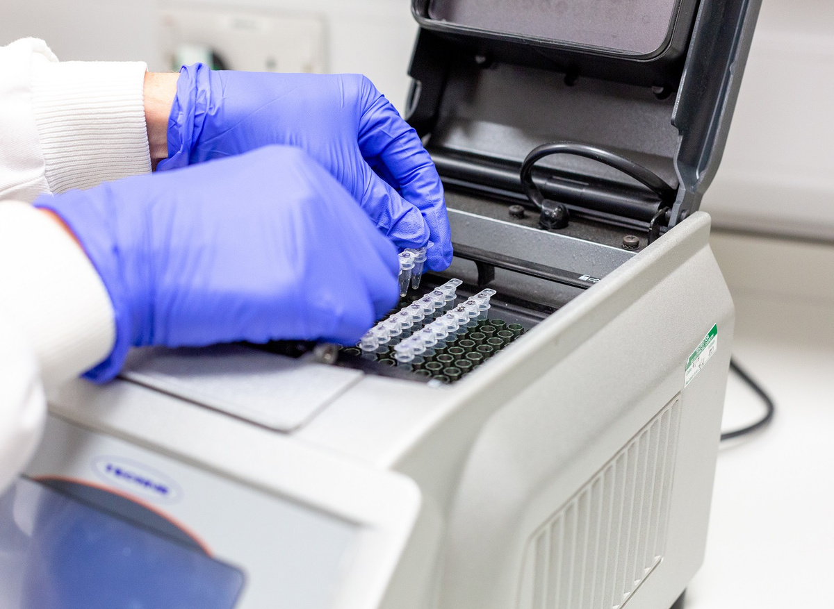 Liverpool ocular pathology molecular scientists