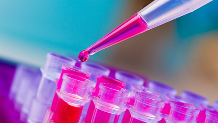 test_tubes_haematology_37957773_785x400px.jpg