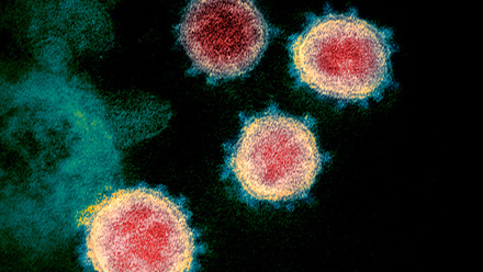 COVID-19 coronavirus particles TEM-SPL red small